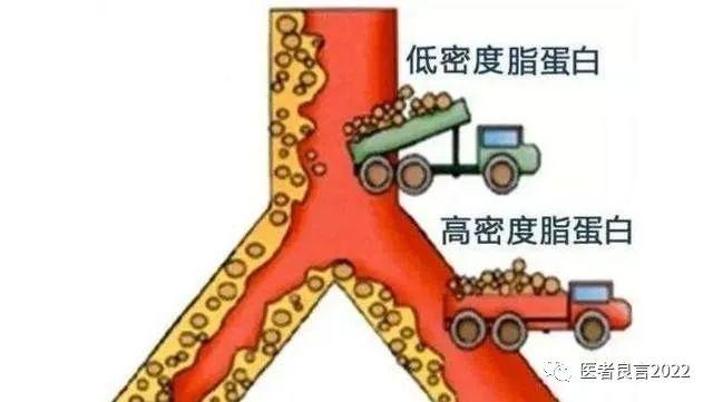 爱吃肉的人和爱吃素的人，哪个更长寿呢？医生告诉您答案