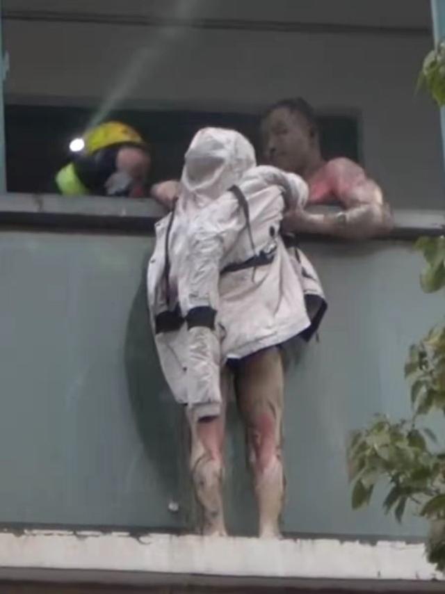 丈夫火灾中救下的妻子因感染离世，家属：很突然，明明第二次手术后都是好好的