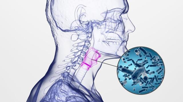 扁桃体角化物是什么