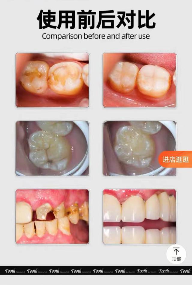 10 岁娃的牙烂 6 颗！这些「坑牙产品」你还在用吗？