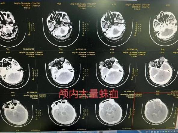 抽旱烟治脸黄 吃活蝌蚪喝蟑螂水 这些离谱的 偏方