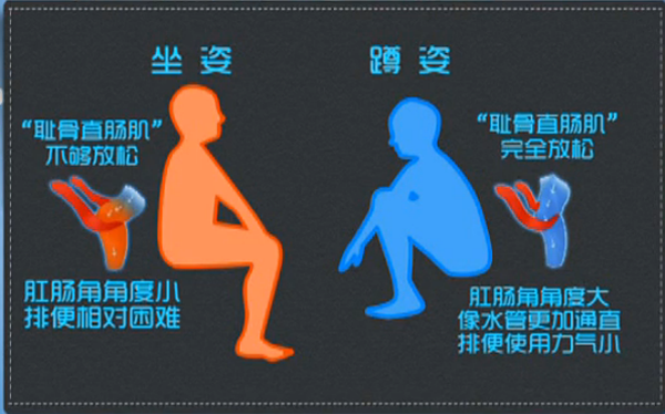 你见过蹲坐两用的马桶？在蹲便器上装个圈，如厕实现两全其美