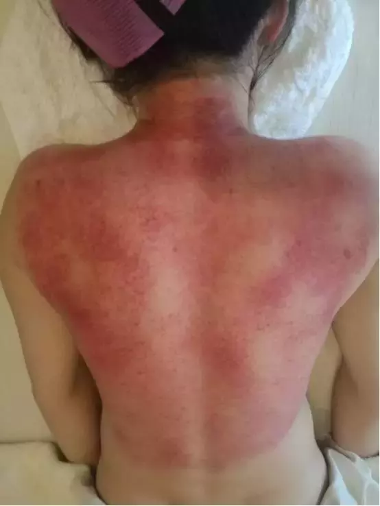 泌乳素失常后果很严重，炁脉调理改善很简单