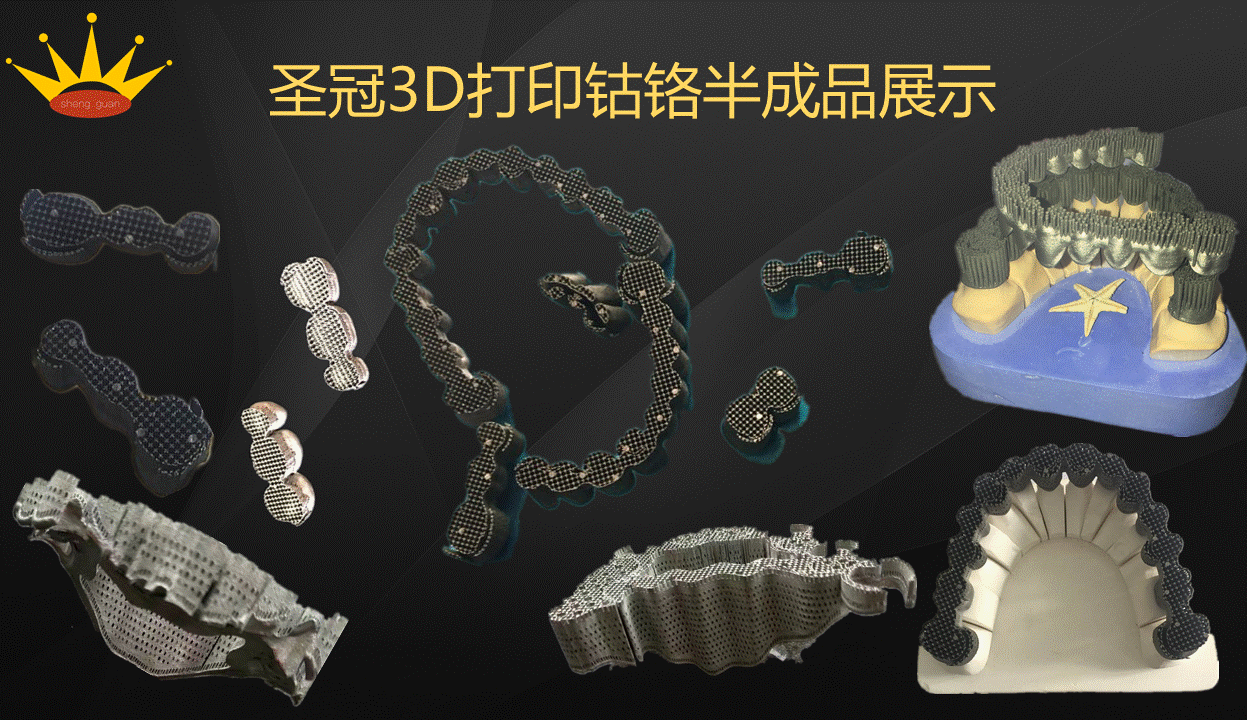 口腔3D打印技术---高科技为您造好牙