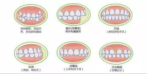 扒一扒︱你可能不知道“宝宝抿嘴笑”的原因！