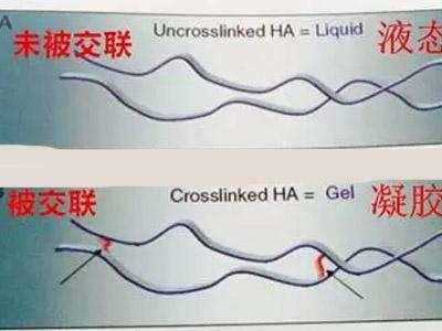 能卖到2万+的玻尿酸，和3千的有啥不一样？