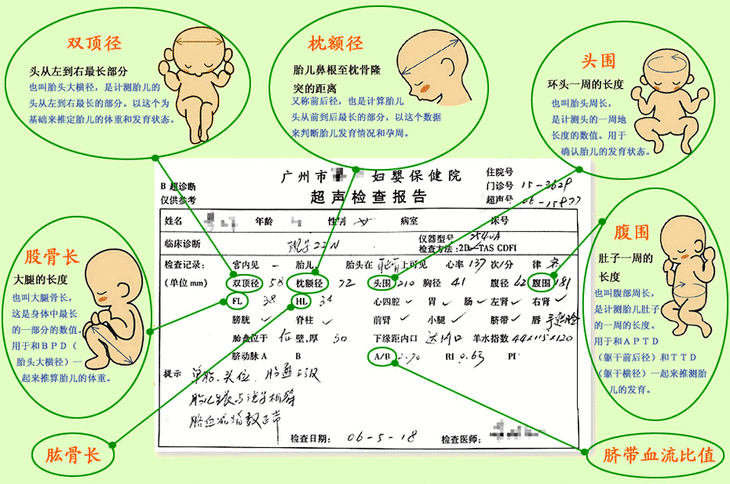 孕期必要的B超检查要做几次？那些英文字母代表啥？专家为你解惑