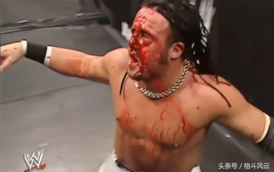 WWE最惨痛的失误，有人毁容，有人脖子断了，还有人死在擂台上！