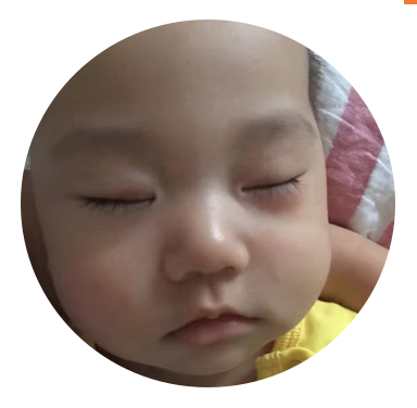 宝宝总有眼袋眼睛肿是为什么？