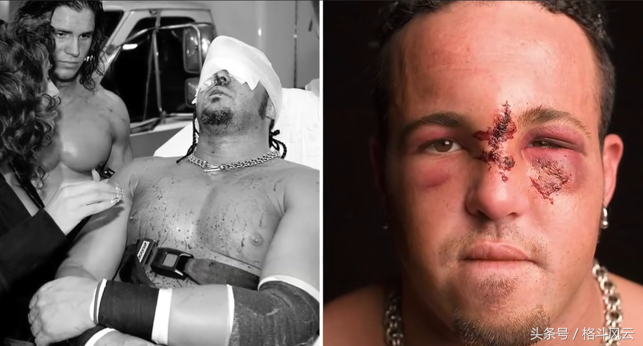 WWE最惨痛的失误，有人毁容，有人脖子断了，还有人死在擂台上！