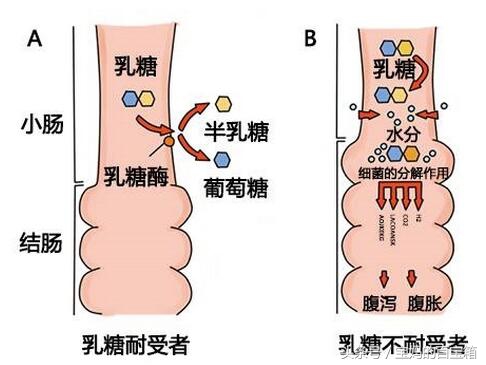 宝宝乳糖不耐受？搞清病理就不再难受！选择奶粉有讲究