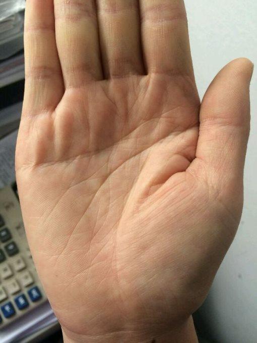 生命线有岛纹,说明你30岁左右身体会出现问题,事业前期比较坎坷,多遇