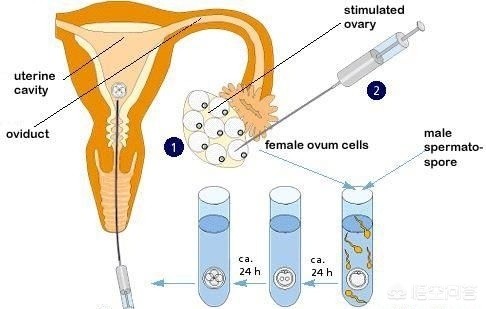 试管婴儿和正常婴儿有什么区别？