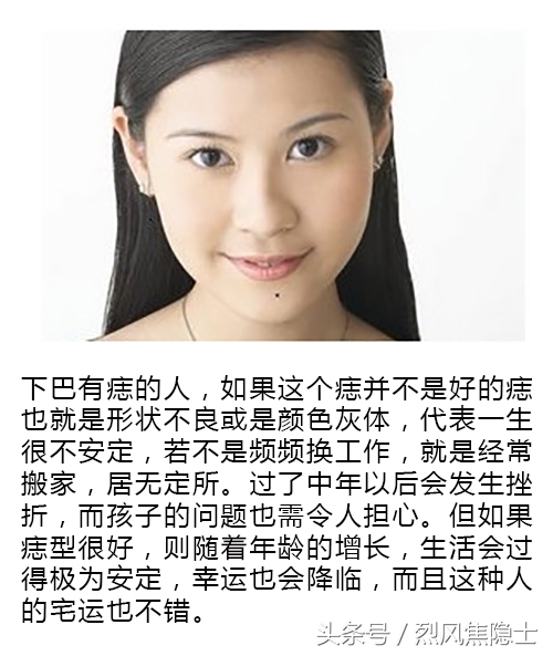 女人痣相图解(上)(真人示例,赶紧对照你是哪一种)