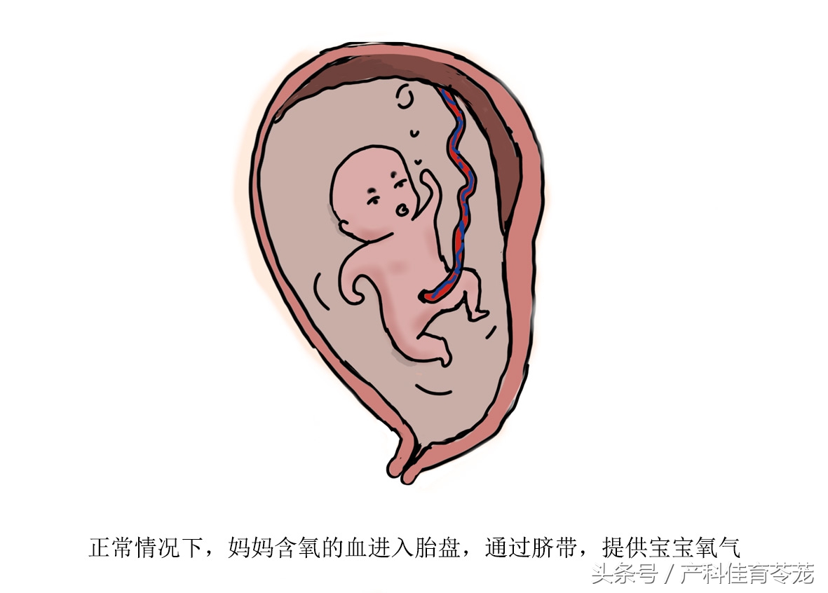 什么是胎盘早剥?