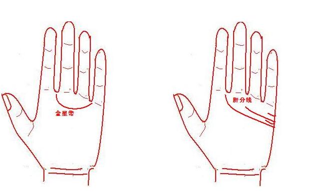 掌纹预示出肝癌早期征兆,"肝"不好看手就知道了!