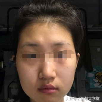 这种面相的特点在于耳朵偏大,但从正面看,几乎看不见耳朵.