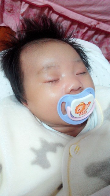 宝宝黄疸12.5!医生要求照蓝光没答应,在家做了几件事,三天退疸!