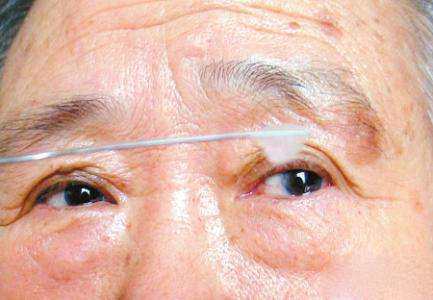 眼角有白色分泌物是怎么回事(分泌物过多的三个原因)