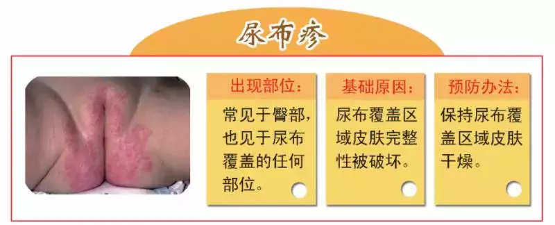 别一看到小红点，就当湿疹、痱子治，先看图认对再下手！