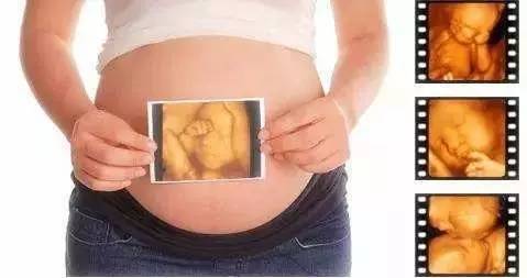 产检报告单，你看得懂么？