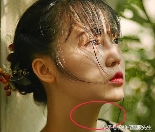 脖子上长痣主富贵,40岁之后运势上涨,家大业大荣华享不尽