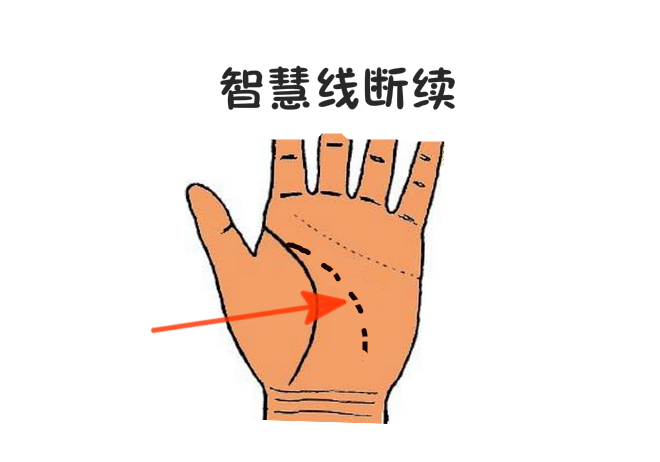 如果智慧线断开,会发生什么呢?