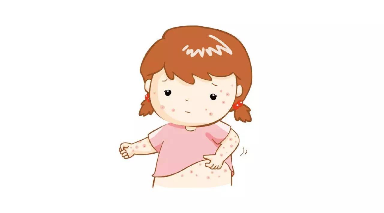 湿疹,多半是过敏惹的祸