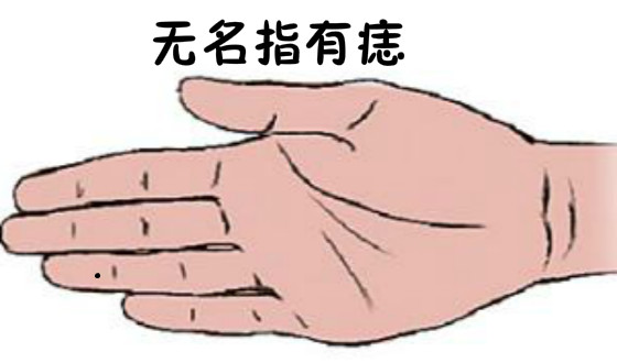 女人小指上有痣代表什么 小指有痣解析_达一风水网