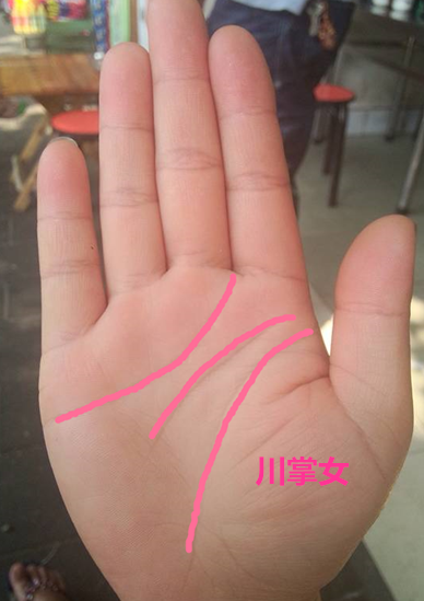 小拇指有痣代表什么(女人右手小拇指有痣代表什么)