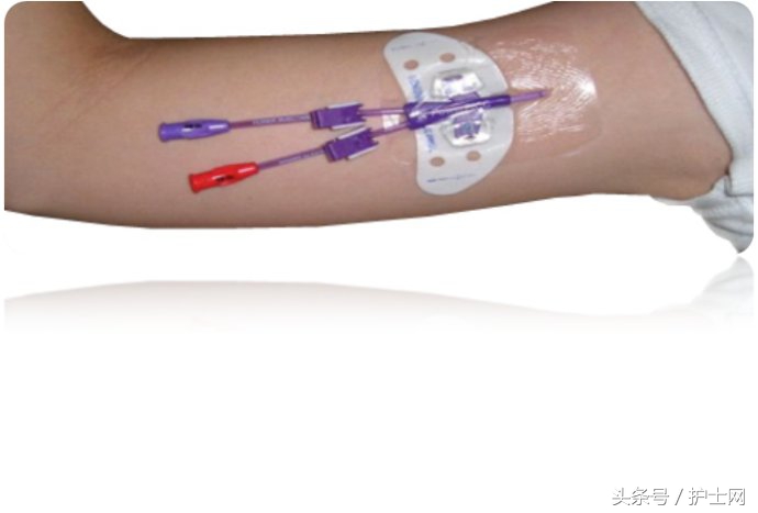 picc的标准维护picc标准化维护