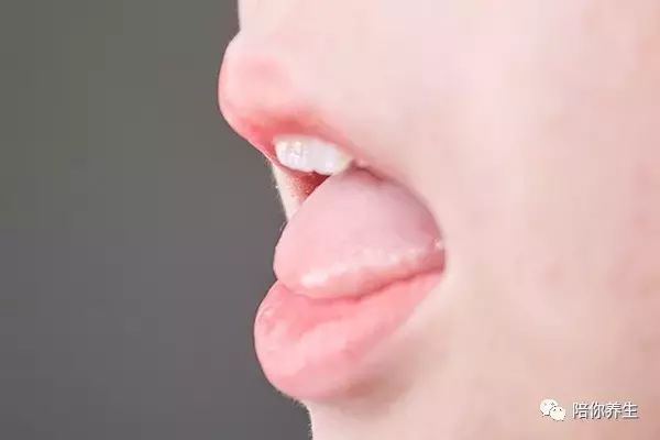 舌苔厚白是怎么回事 教你从舌苔中判断健康情况
