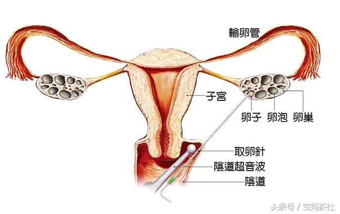 试管婴儿究竟要花多少钱？受多少罪？让你全面了解试管婴儿