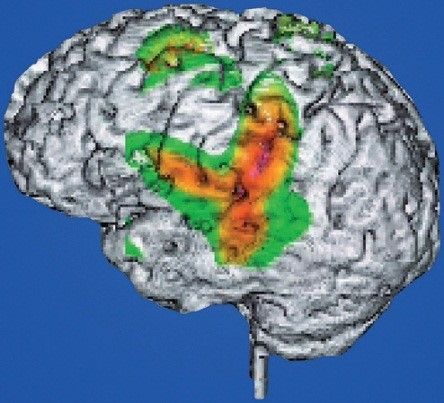 核磁共振成像儀的未來：或成為人類思維的閱讀器