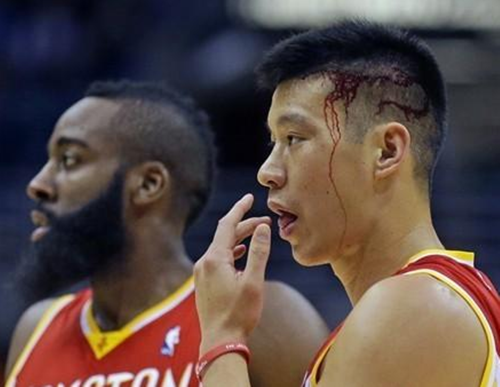 nba哪些球星眉骨受伤过(NBA球星浴血奋战：纳什鼻子被撞烂，答案吞血战神！)