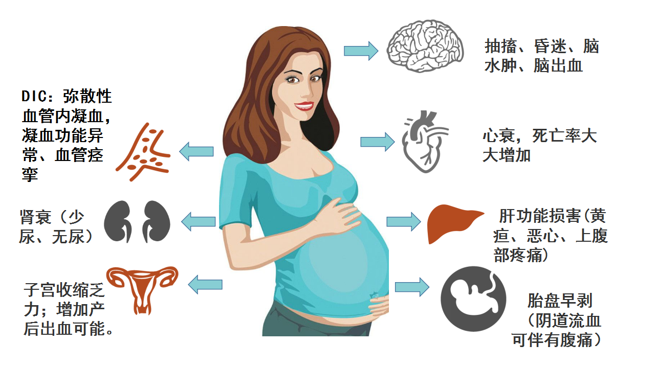 孕期营养专题：妊娠期高血压（一）