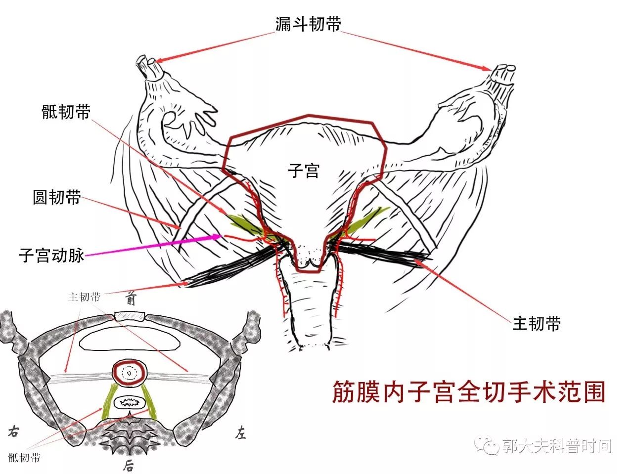 自宫是切除哪里(关于子宫切除的小秘密（一）——切除范围)