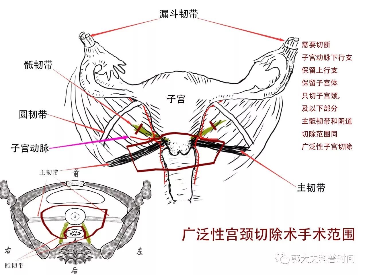 自宫是切除哪里(关于子宫切除的小秘密（一）——切除范围)