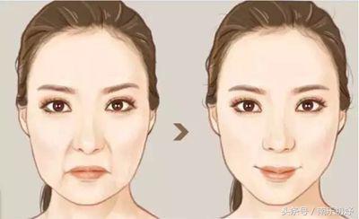 天生一张“囧”脸？做完PST面部提升会变红脸僵尸or年轻？