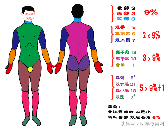 烧伤面积口诀三三三五六七（成人烧伤面积计算口诀）附例题