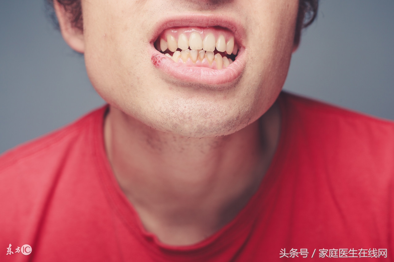 牙齿太黄怎么办？医生教你两招，快速美白牙齿！