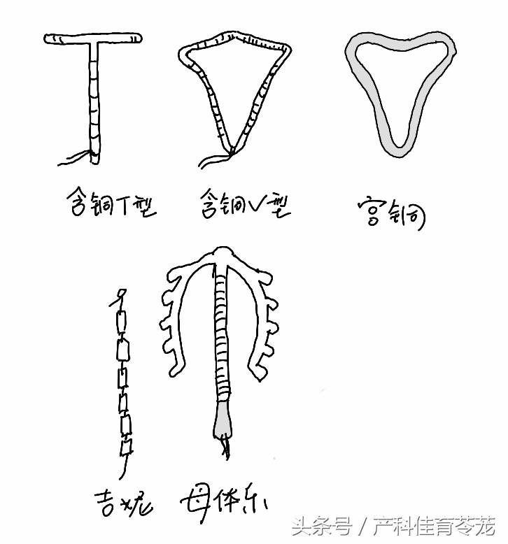 上环图解宫内节育器放置流程