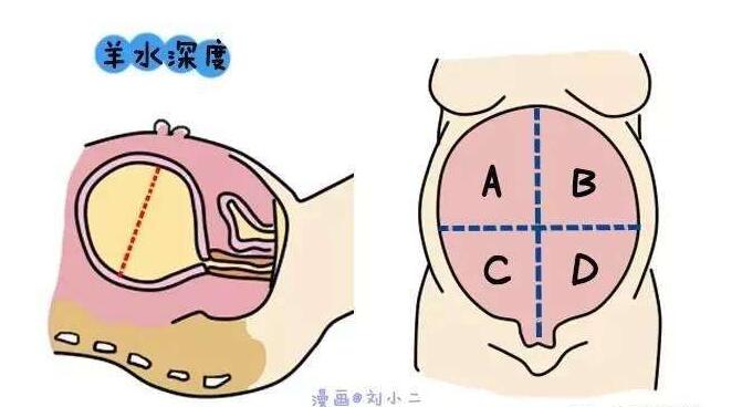 怀孕妈妈为补羊水一天狂饮2.5L矿泉水，结果比缺羊水更可怕