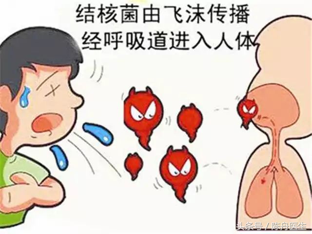 一文读懂：肺结核！