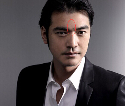 4,颧骨代表掌权,颧骨有痣的话管理方面可能出错,生意上碰到麻烦事