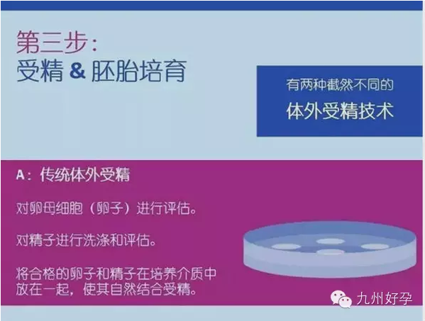 试管婴儿的五个具体步骤是什么？