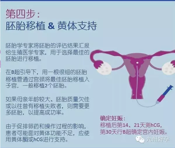 试管婴儿的五个具体步骤是什么？
