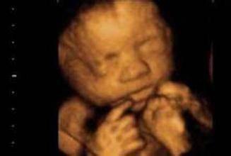 孕6月，确认男宝，一切所谓生男症状都是纸老虎，快乐宝妈来接