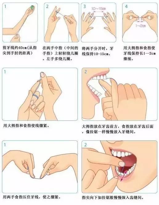 健牙卫士——牙线