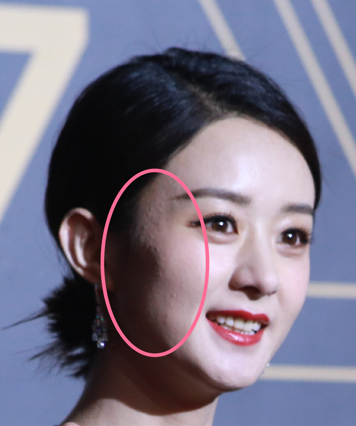 明星生图,"赫敏"抬头纹法令纹真实呈现,水果姐浓妆盖不住毛孔